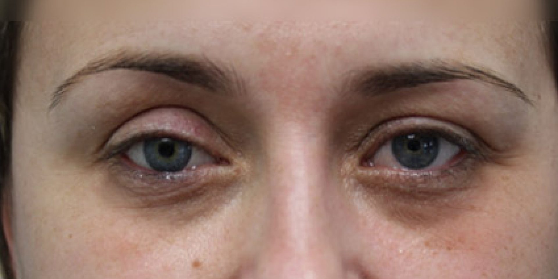 Prothèse Oculaire Artificielle Yeux Bleus Avec étui De Sécurité - Neuf, Marque TR, Modèle TR83211